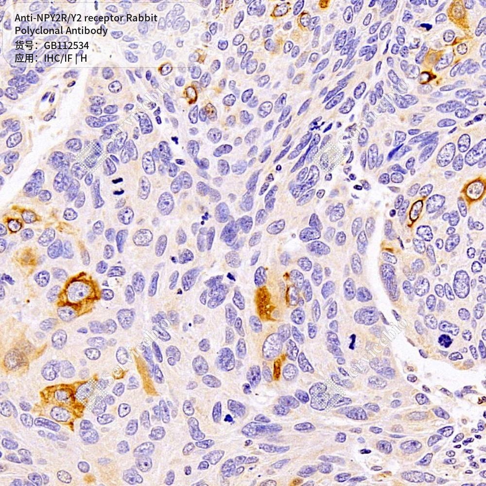 Антитела первичные, поликлональные кролика к NPY2R/Y2 receptor человека, 100 мкл