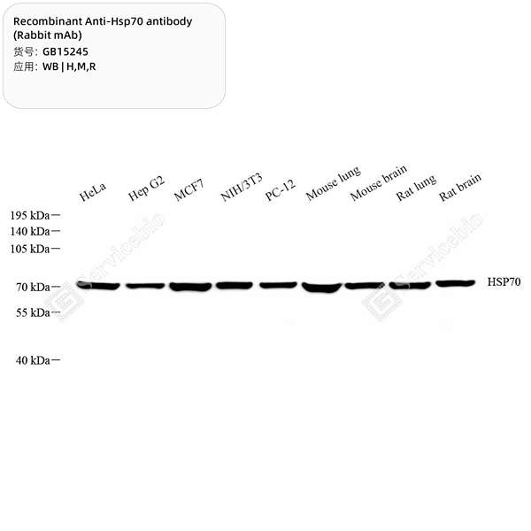 Антитела первичные, моноклональные, Hsp70, 100 мкл