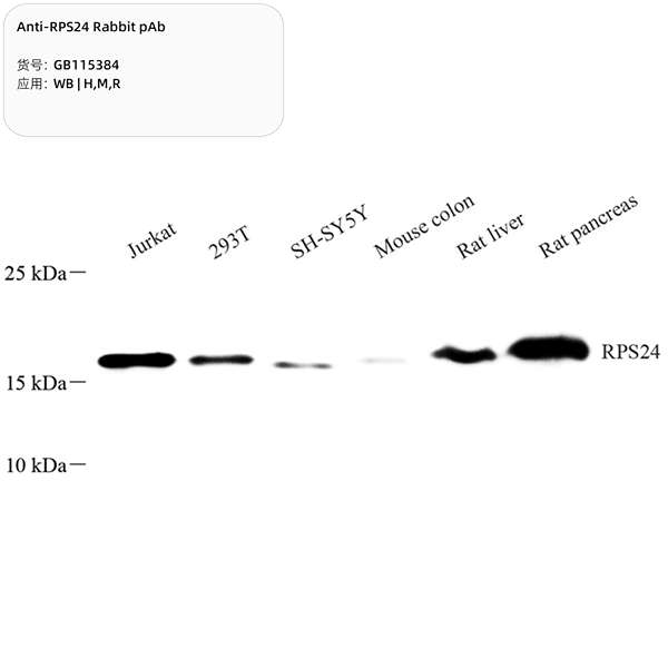 Антитела первичные, поликлональные, RPS24, 100 мкл