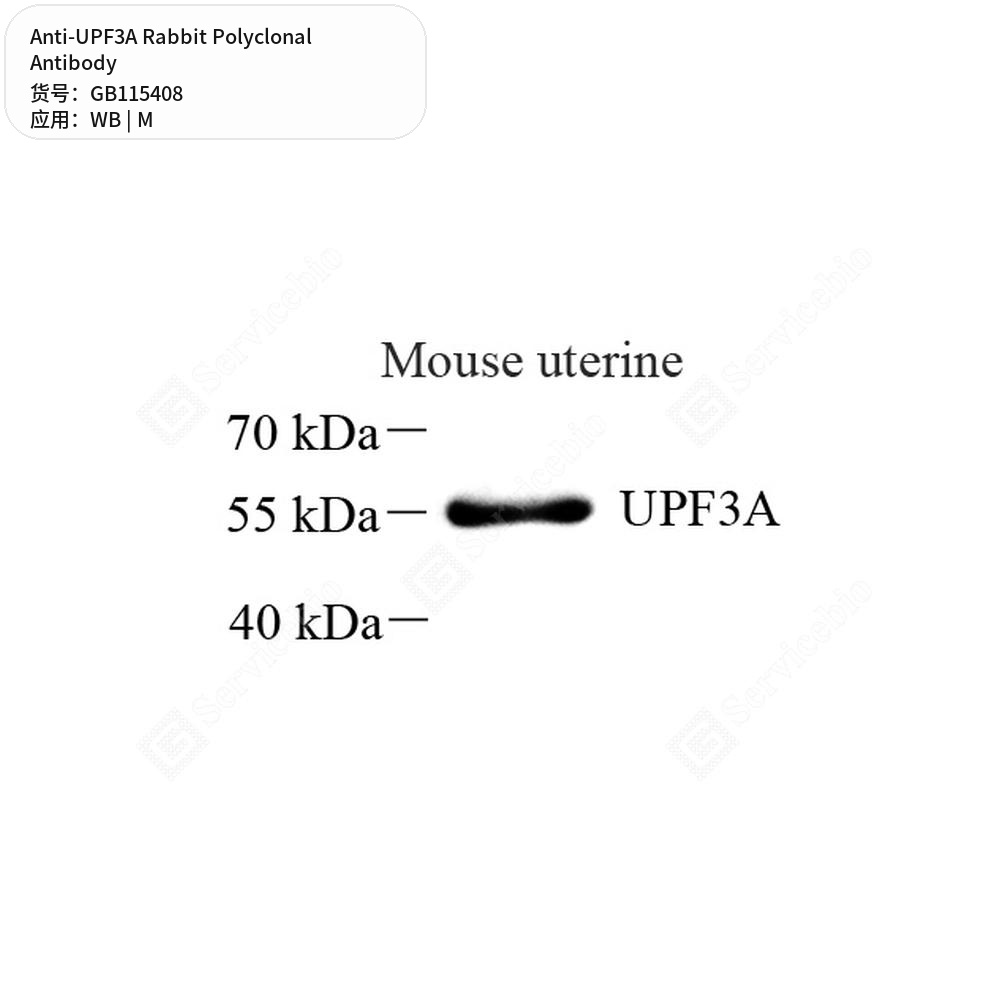Антитела первичные, поликлональные кролика к UPF3A мыши, 50 мкл