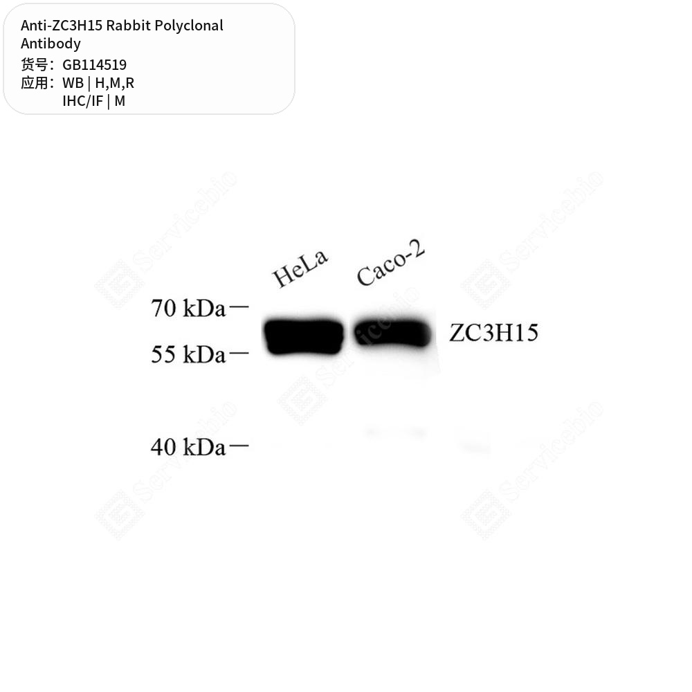 Антитела первичные, поликлональные кролика к ZC3H15 крысы, мыши, человека, 50 мкл