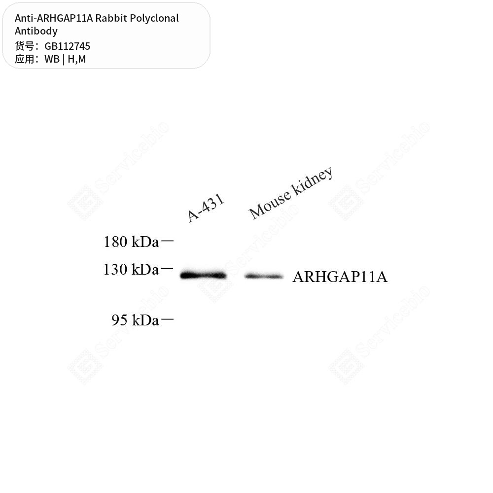 Антитела первичные, поликлональные кролика к ARHGAP11A мыши, человека, 100 мкл