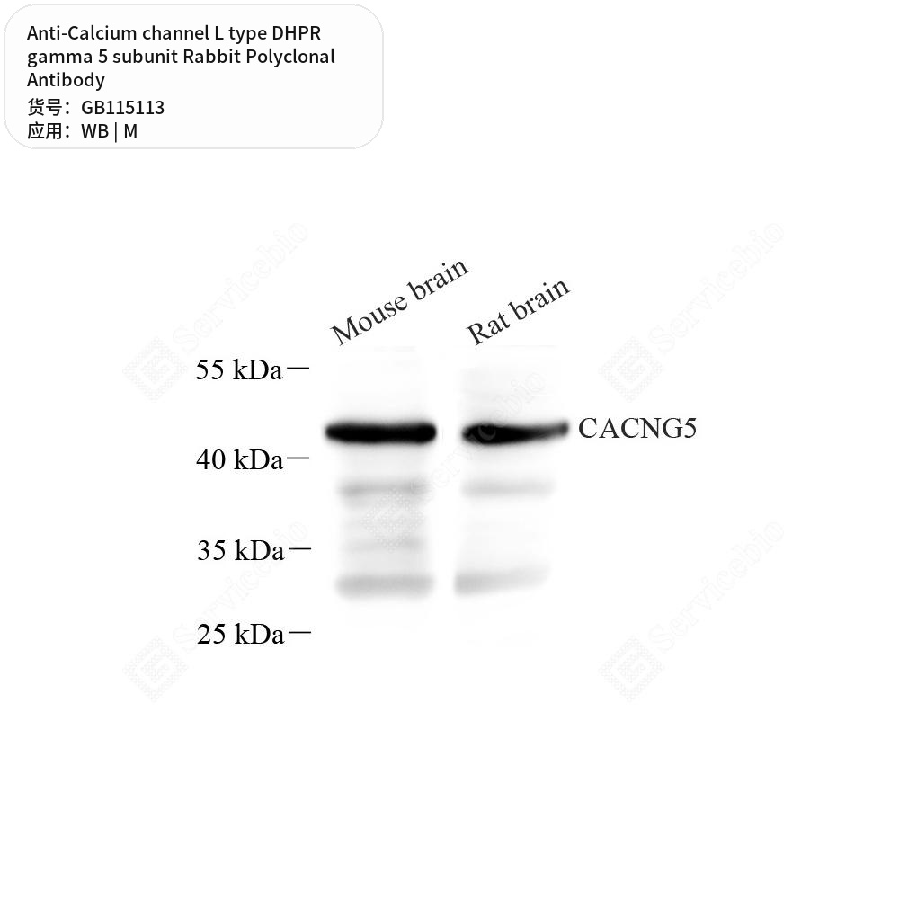 Антитела первичные, поликл. кролика к Calcium channel L type DHPR gamma 5 subunit мыши, 50 мкл