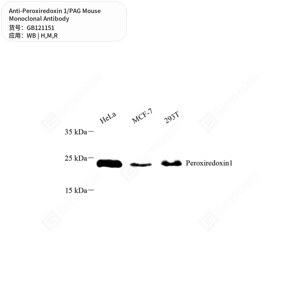 Антитела первичные, моноклональные мыши к Peroxiredoxin 1/PAG крысы, мыши, человека, 50 мкл