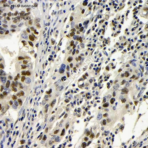 Антитела первичные, поликлональные, BRCA1, 100 мкл