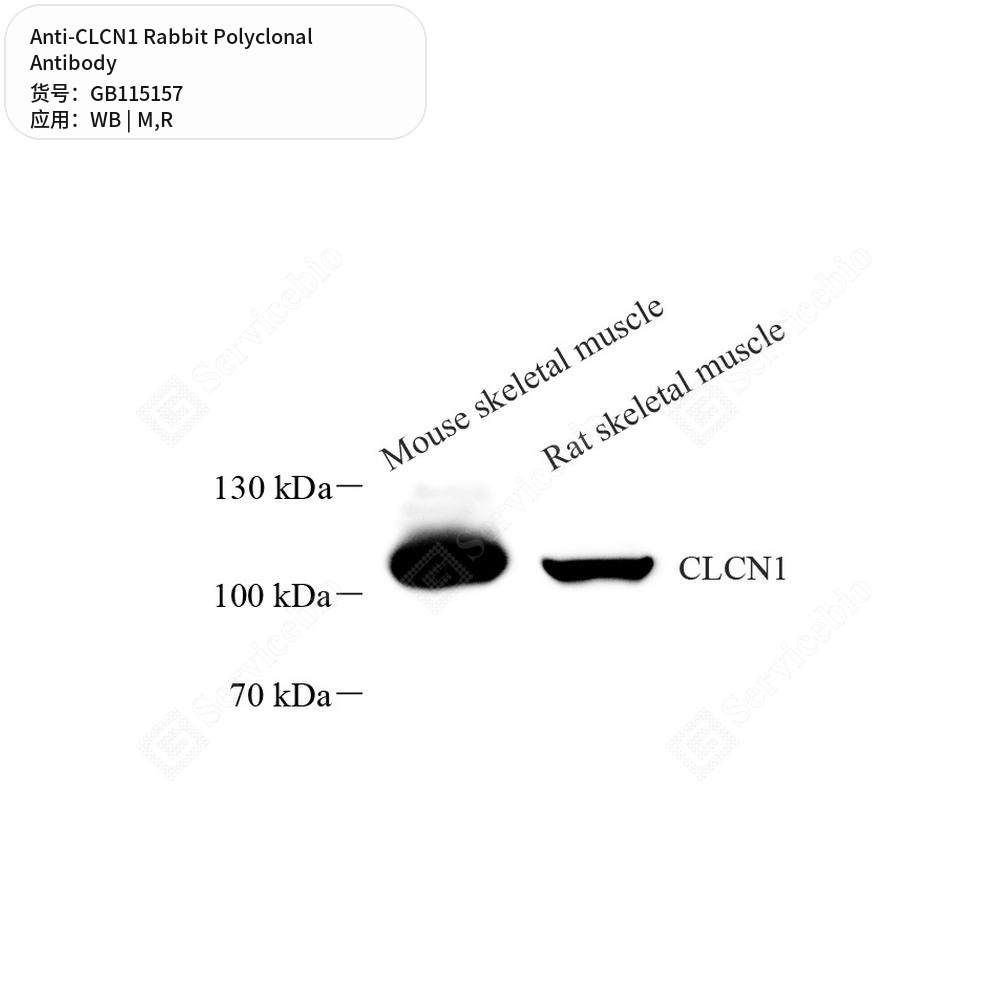 Антитела первичные, поликлональные кролика к CLCN1 крысы, мыши, 100 мкл