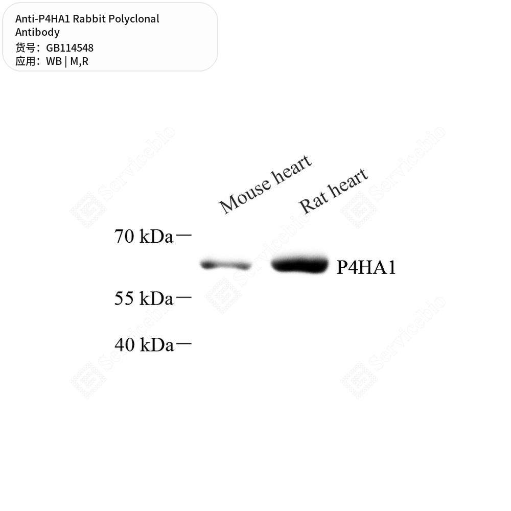 Антитела первичные, поликлональные кролика к P4HA1 крысы, мыши, 100 мкл