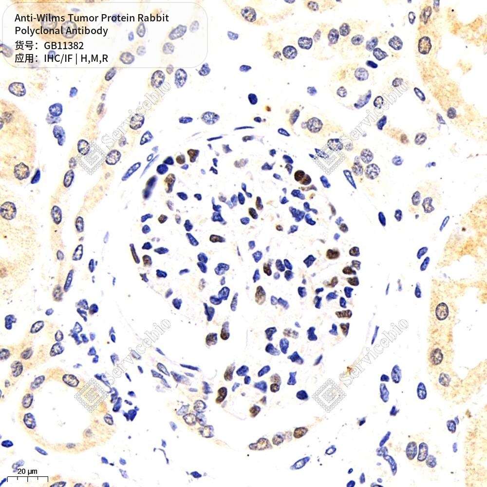 Антитела первичные, поликлональные кролика к Wilms Tumor Protein крысы, мыши, человека, 100 мкл