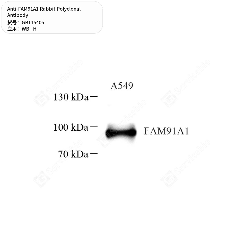 Антитела первичные, поликлональные кролика к FAM91A1 человека, 50 мкл