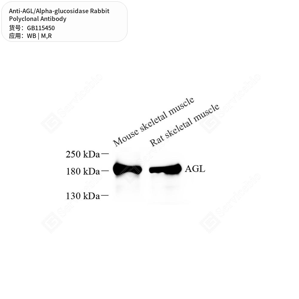 Антитела первичные, поликлональные кролика к AGL/Alpha-glucosidase крысы, мыши, 50 мкл