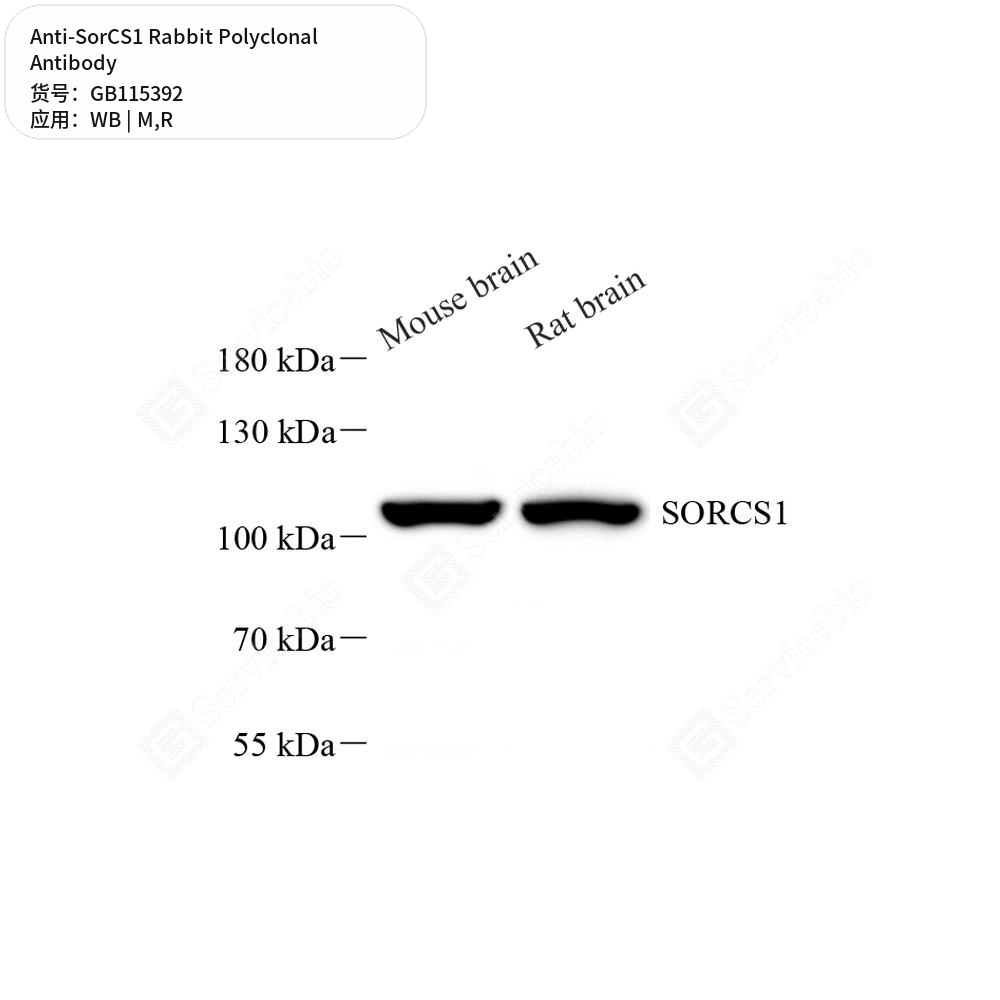 Антитела первичные, поликлональные кролика к SorCS1 крысы, мыши, 100 мкл