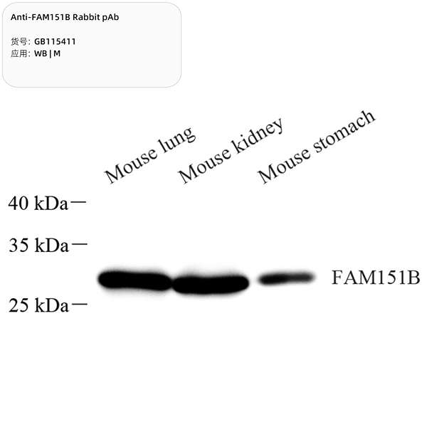 Антитела первичные, поликлональные, FAM151B, 100 мкл