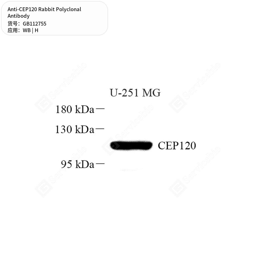 Антитела первичные, поликлональные кролика к CEP120 человека, 50 мкл