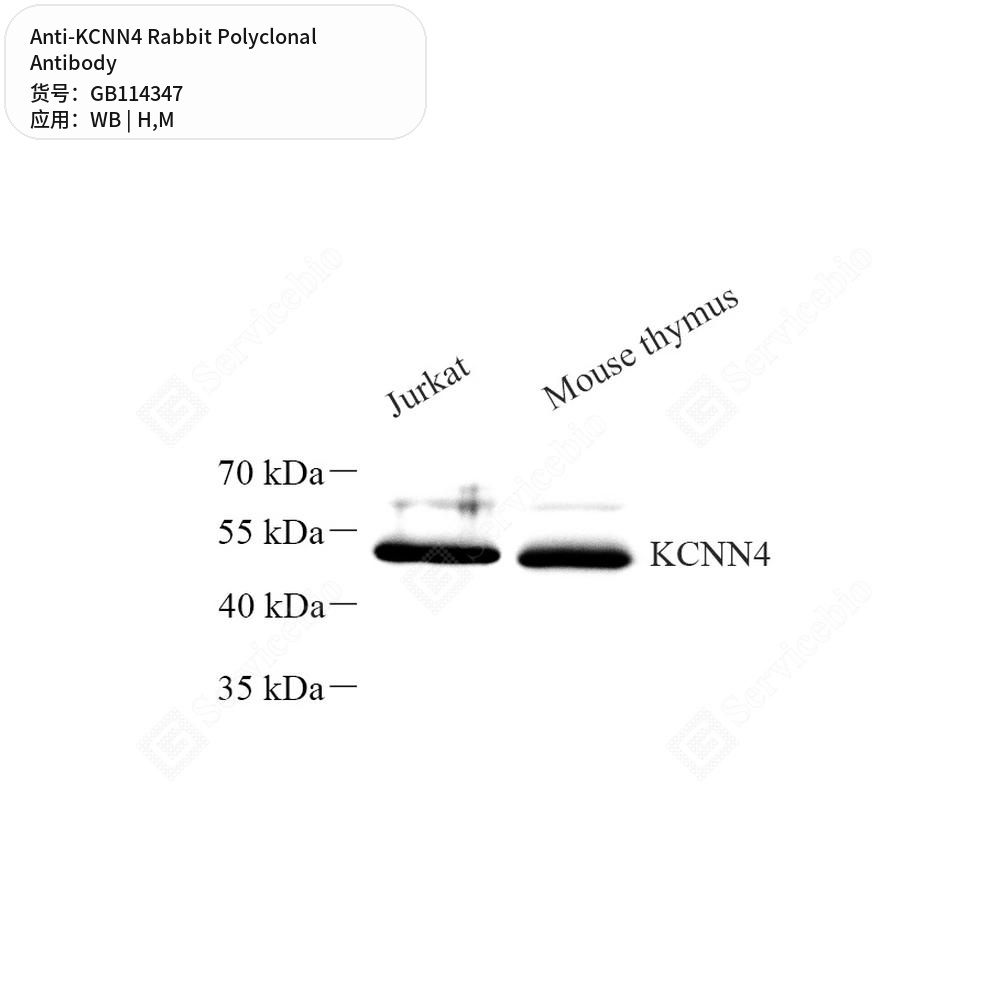 Антитела первичные, поликлональные кролика к KCNN4 мыши, человека, 100 мкл