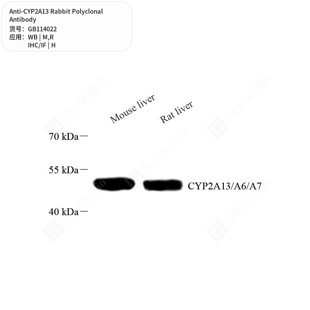 Антитела первичные, поликлональные кролика к CYP2A13 крысы, мыши, человека, 100 мкл