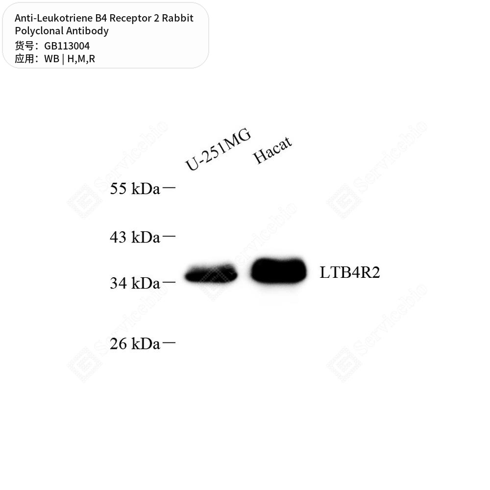 Антитела первичные, поликл. кролика к Leukotriene B4 Receptor 2 крысы, мыши, человека, 100 мкл