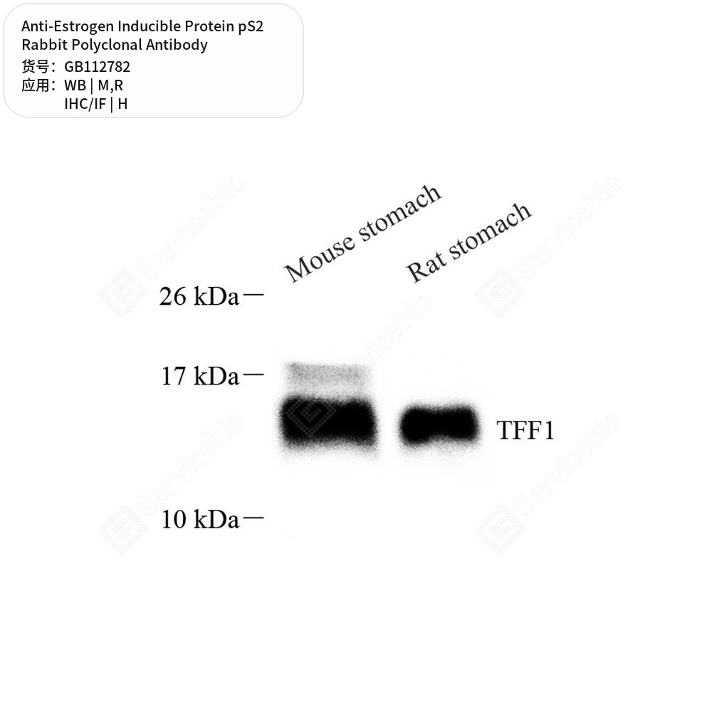 Антитела первичные, поликл. кролика к Estrogen Inducible Protein pS2 крысы, мыши, человека, 100 мкл