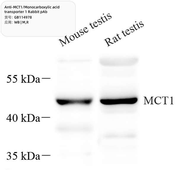 Антитела первичные, поликлональные, MCT1/Monocarboxylic acid transporter 1, 100 мкл