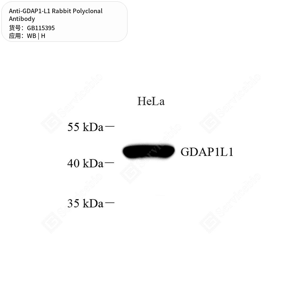 Антитела первичные, поликлональные кролика к GDAP1-L1 человека, 50 мкл