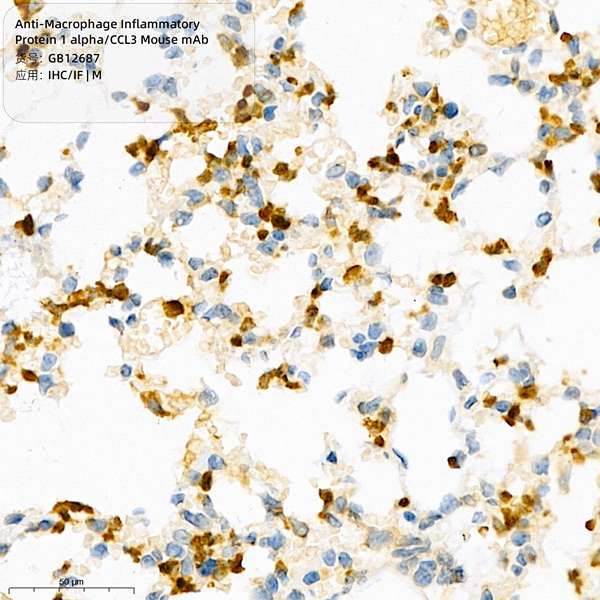 Антитела первичные, моноклональные, Macrophage Inflammatory Protein 1 alpha/CCL3, 100 мкл