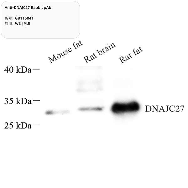 Антитела первичные, поликлональные, DNAJC27, 100 мкл
