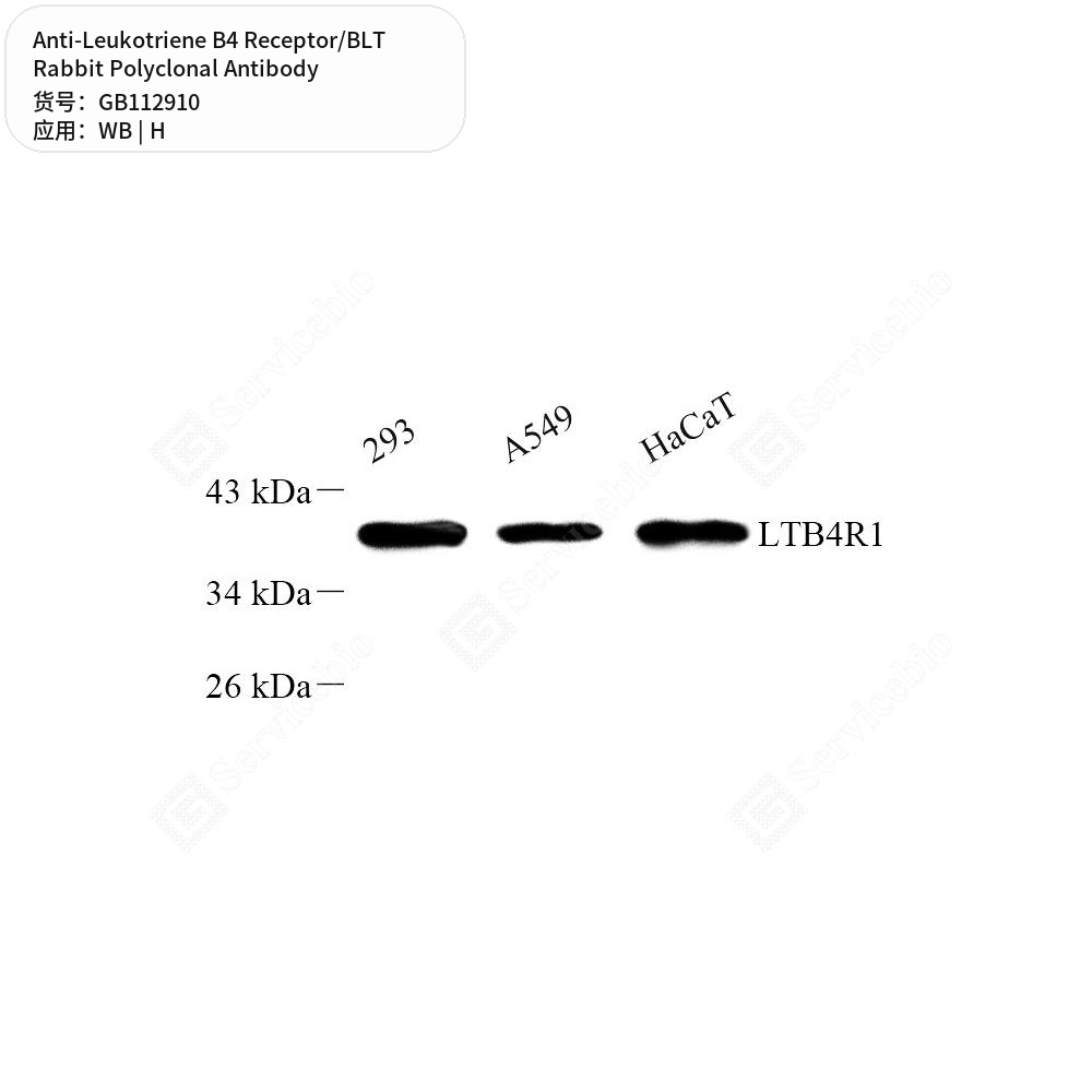 Антитела первичные, поликлональные кролика к Leukotriene B4 Receptor/BLT человека, 50 мкл