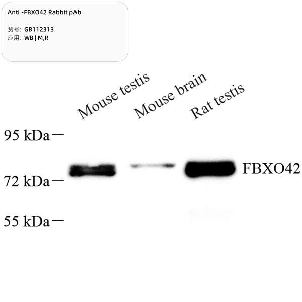 Антитела первичные, поликлональные, FBXO42, 100 мкл