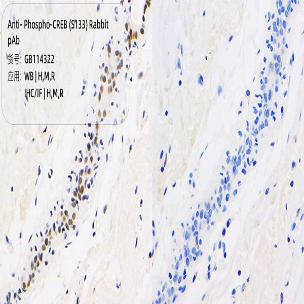 Антитела первичные, поликлональные, Phospho-CREB (S133), 100 мкл