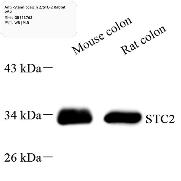 Антитела первичные, поликлональные, Stanniocalcin 2/STC-2, 100 мкл