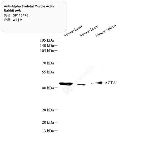 Антитела первичные, поликлональные, alpha Skeletal Muscle Actin, 100 мкл