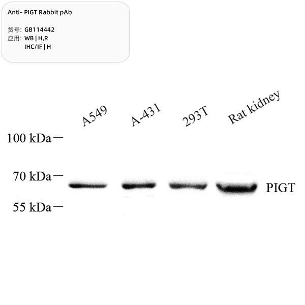 Антитела первичные, поликлональные, PIGT, 100 мкл