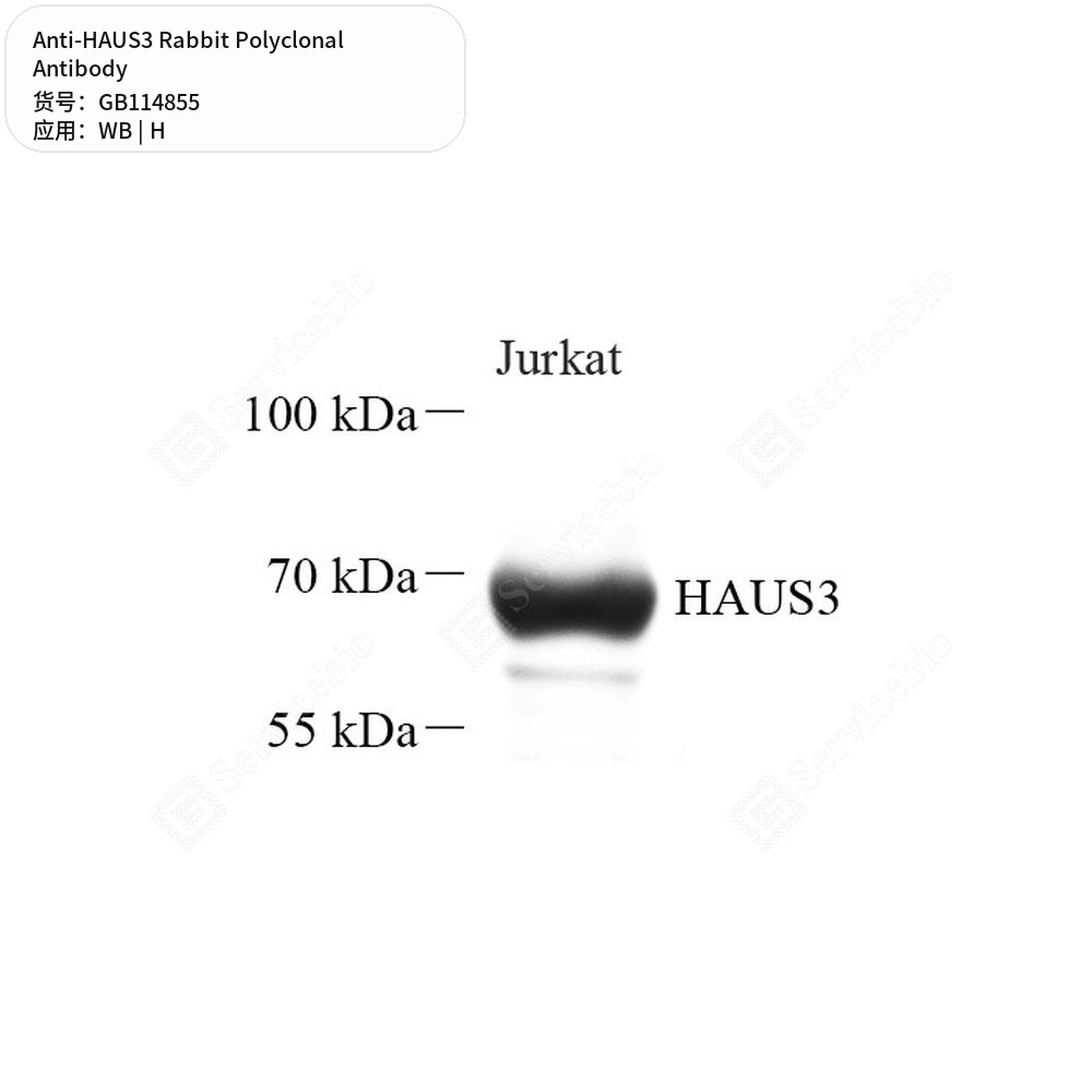 Антитела первичные, поликлональные кролика к HAUS3 человека, 50 мкл