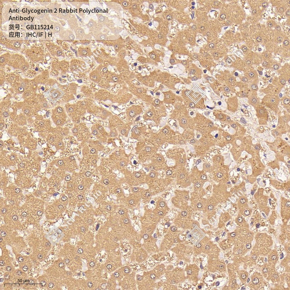 Антитела первичные, поликлональные кролика к Glycogenin 2 человека, 50 мкл