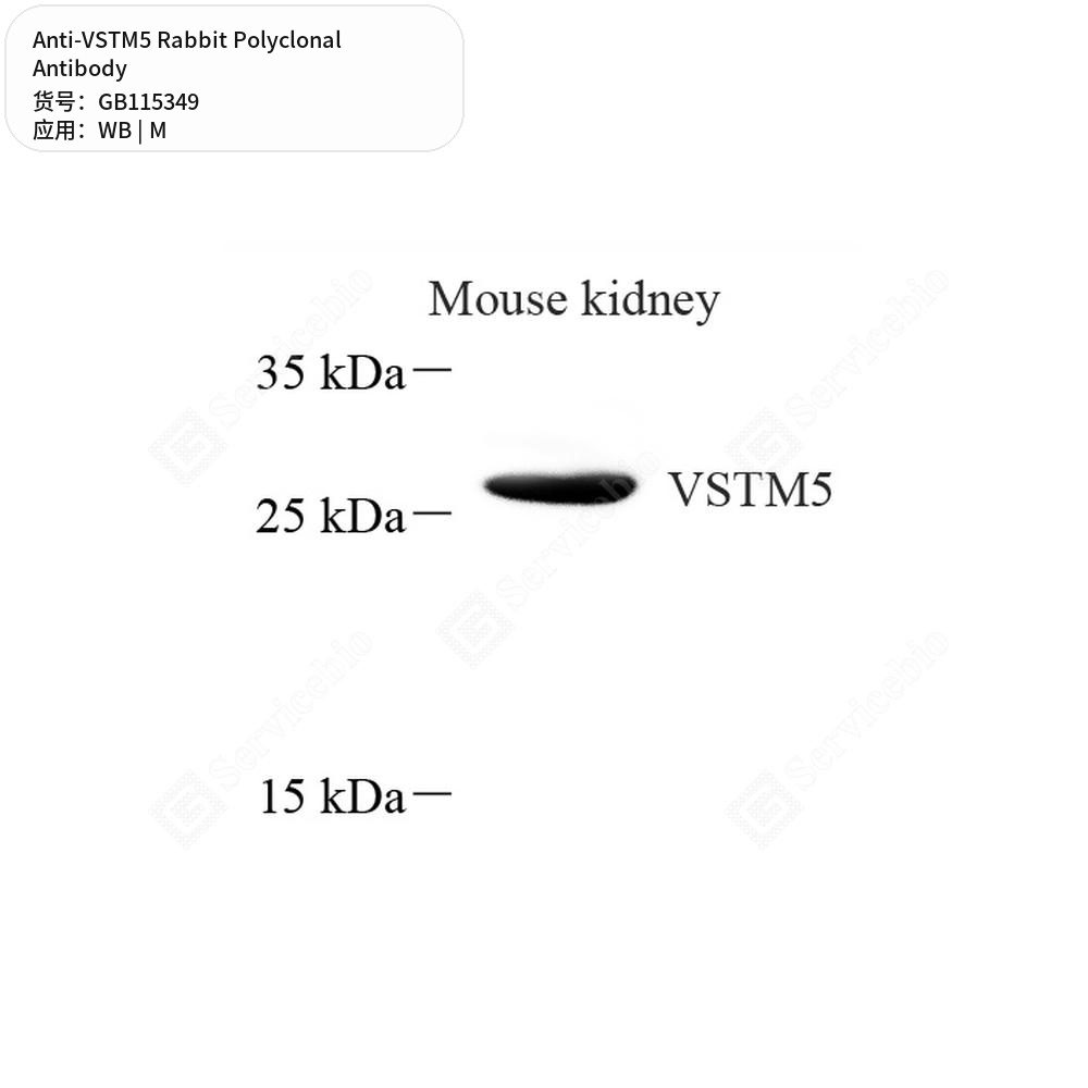 Антитела первичные, поликлональные кролика к VSTM5 мыши, 100 мкл