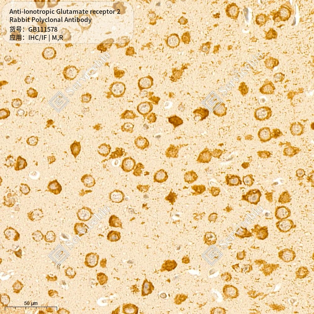 Антитела первичные, поликлональные кролика к Ionotropic Glutamate receptor 2 крысы, мыши, 100 мкл