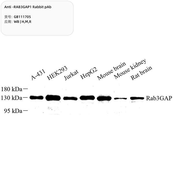 Антитела первичные, поликлональные, RAB3GAP1, 100 мкл