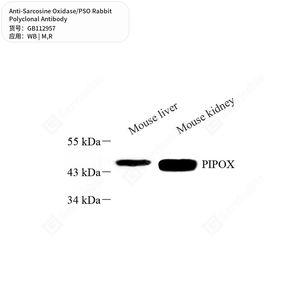 Антитела первичные, поликлональные кролика к Sarcosine Oxidase/PSO крысы, мыши, 50 мкл