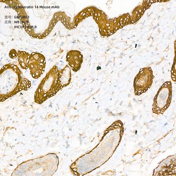 Антитела первичные, моноклональные, Cytokeratin 14, 100 мкл
