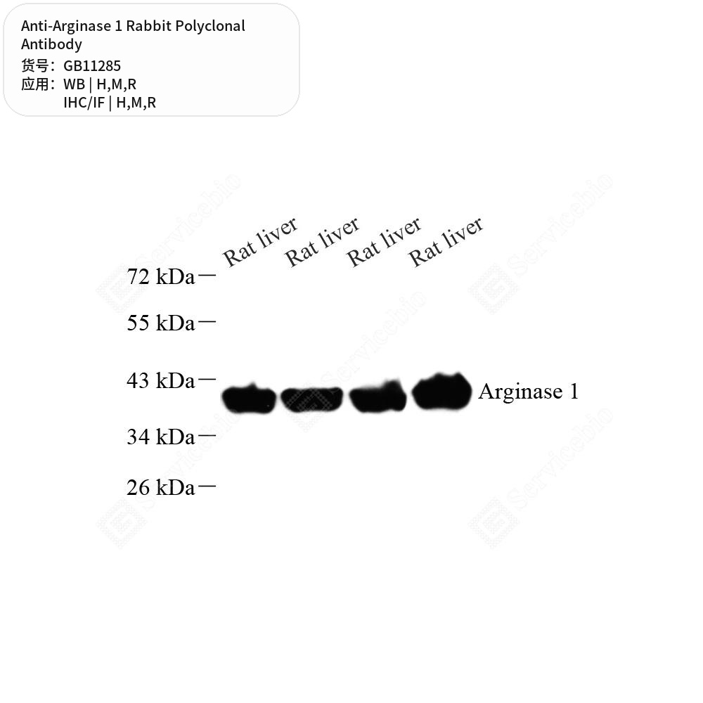 Антитела первичные, поликлональные кролика к Arginase 1 крысы, мыши, человека, 50 мкл