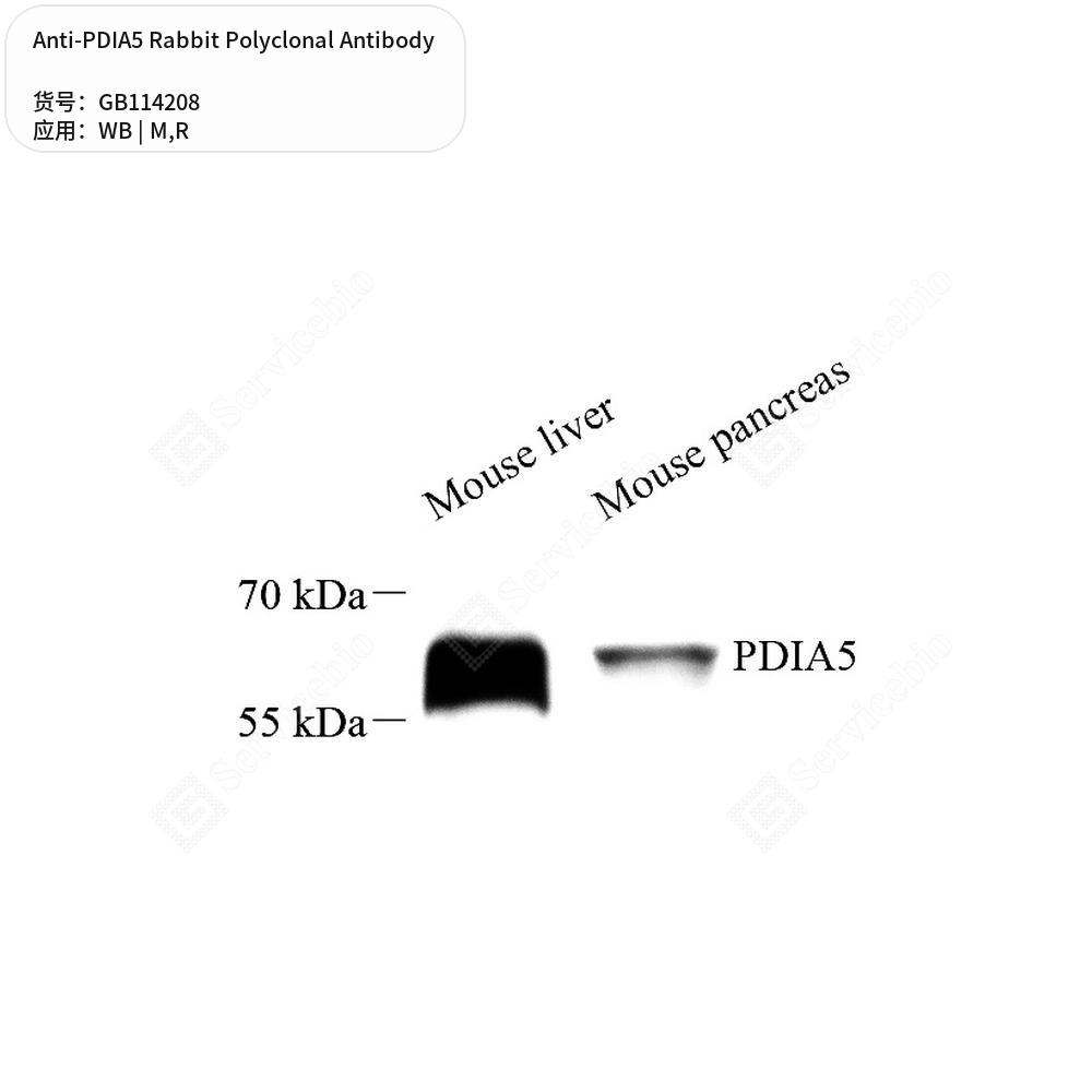 Антитела первичные, поликлональные кролика к PDIA5 крысы, мыши, 50 мкл