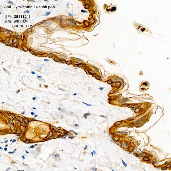 Антитела первичные, поликлональные, Cytokeratin 5, 100 мкл