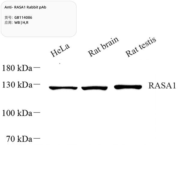 Антитела первичные, поликлональные, RASA1, 100 мкл