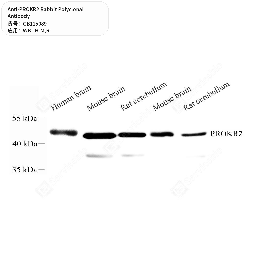 Антитела первичные, поликлональные кролика к PROKR2 крысы, мыши, человека, 50 мкл