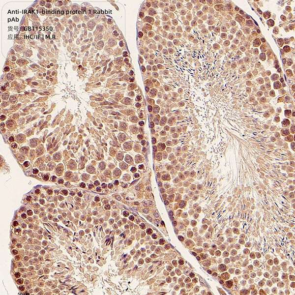 Антитела первичные, поликлональные, IRAK1-binding protein 1, 100 мкл