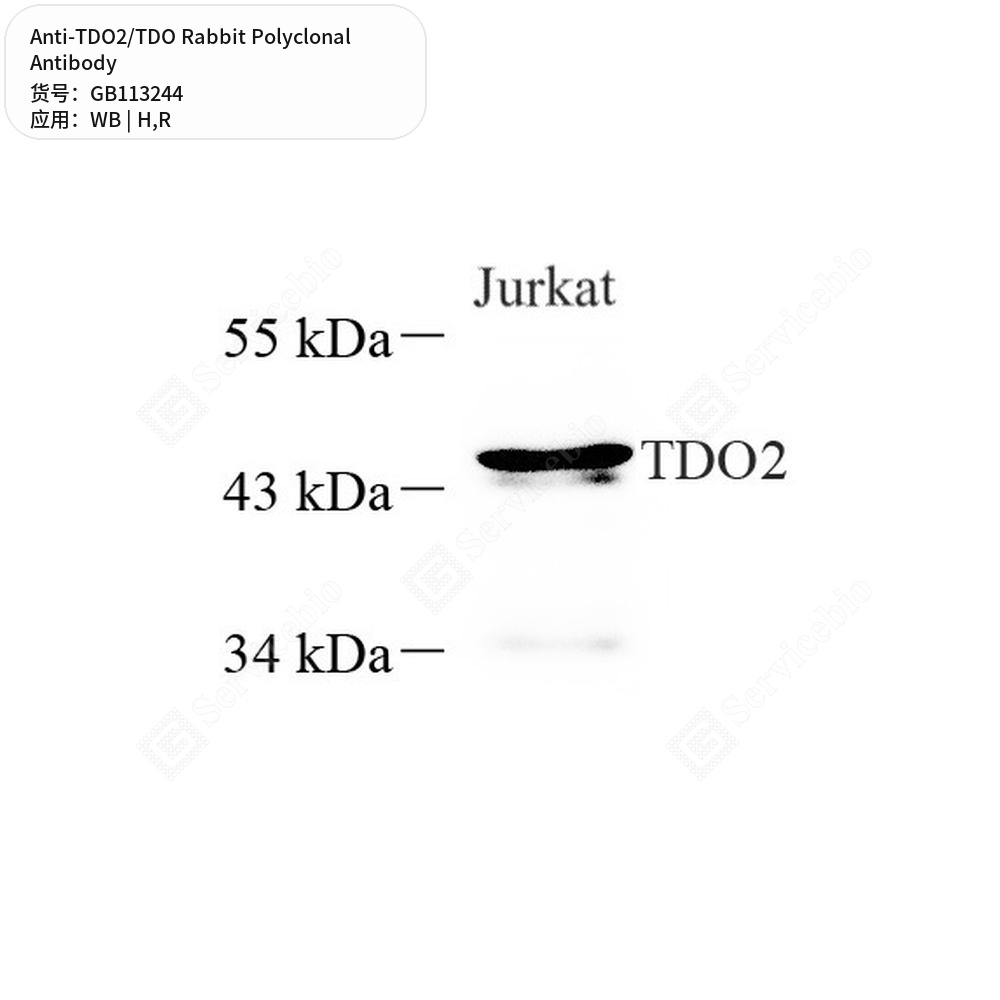 Антитела первичные, поликлональные кролика к TDO2/TDO крысы, человека, 100 мкл