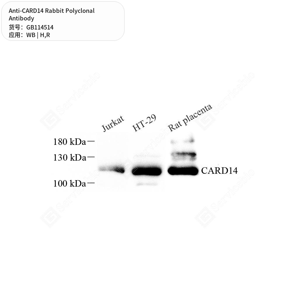 Антитела первичные, поликлональные кролика к CARD14 крысы, человека, 50 мкл