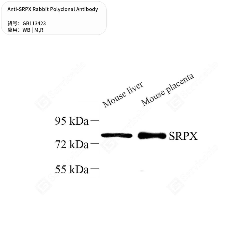Антитела первичные, поликлональные кролика к SRPX крысы, мыши, 50 мкл