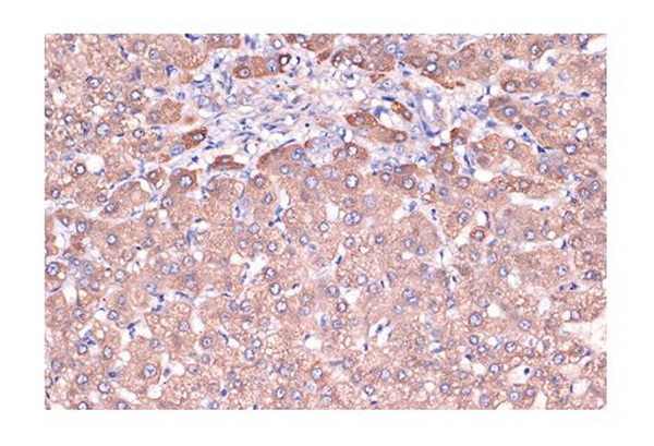 Антитела первичные, моноклональные Haptoglobin (ARC1298), 100 мкл