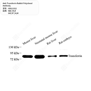 Антитела первичные, поликлональные кролика к Transferrin крысы, мыши, человека, 50 мкл