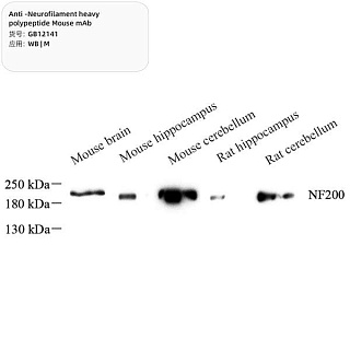 Антитела первичные, моноклональные мыши к Neurofilament heavy polypeptide мыши, 100 мкл